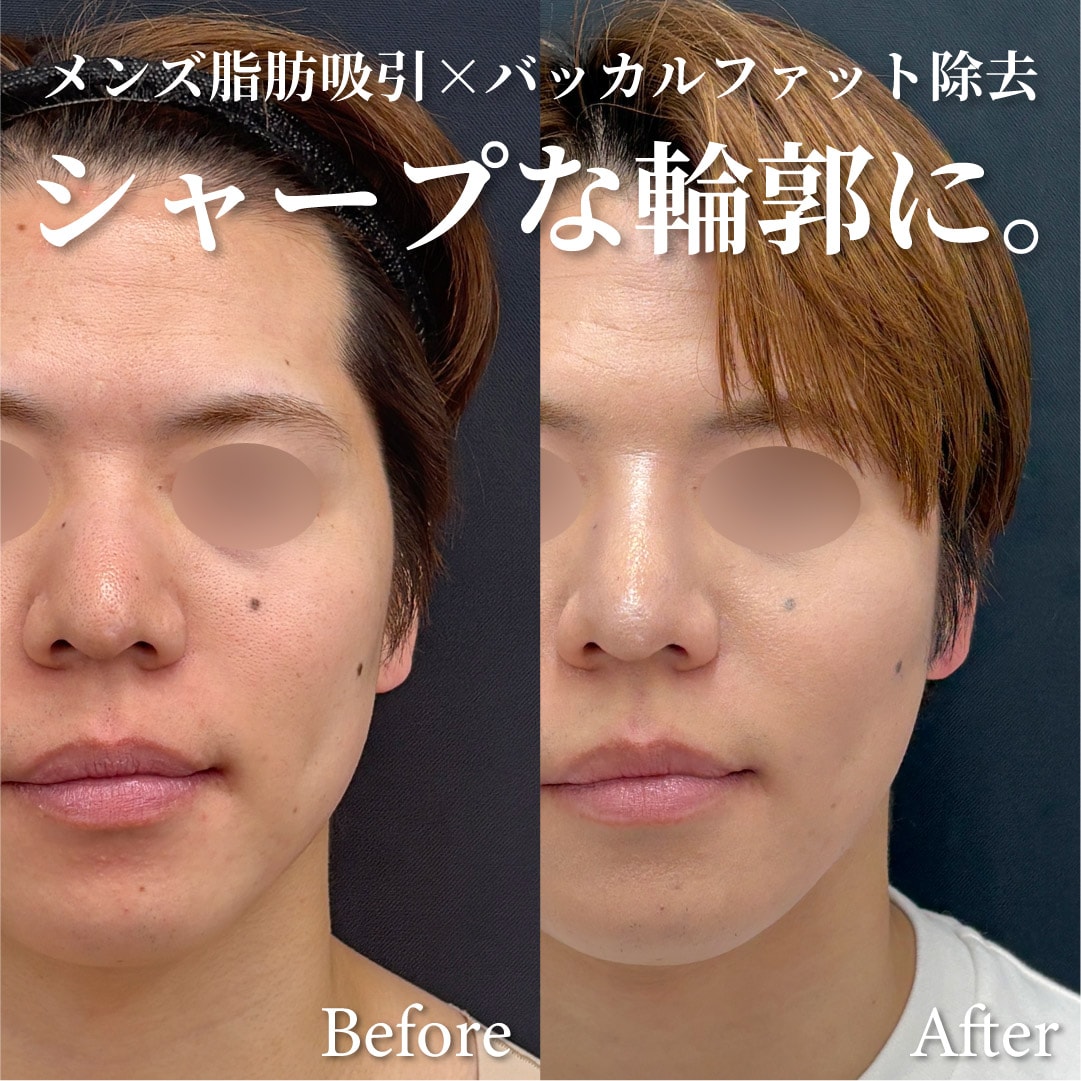 30歳男性のモニター様