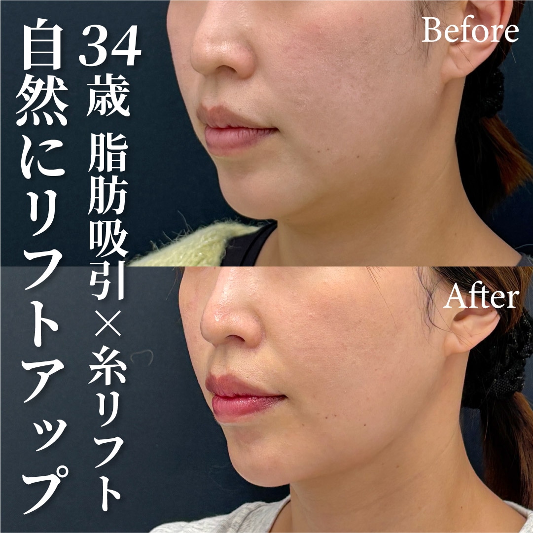 34歳女性のモニター様