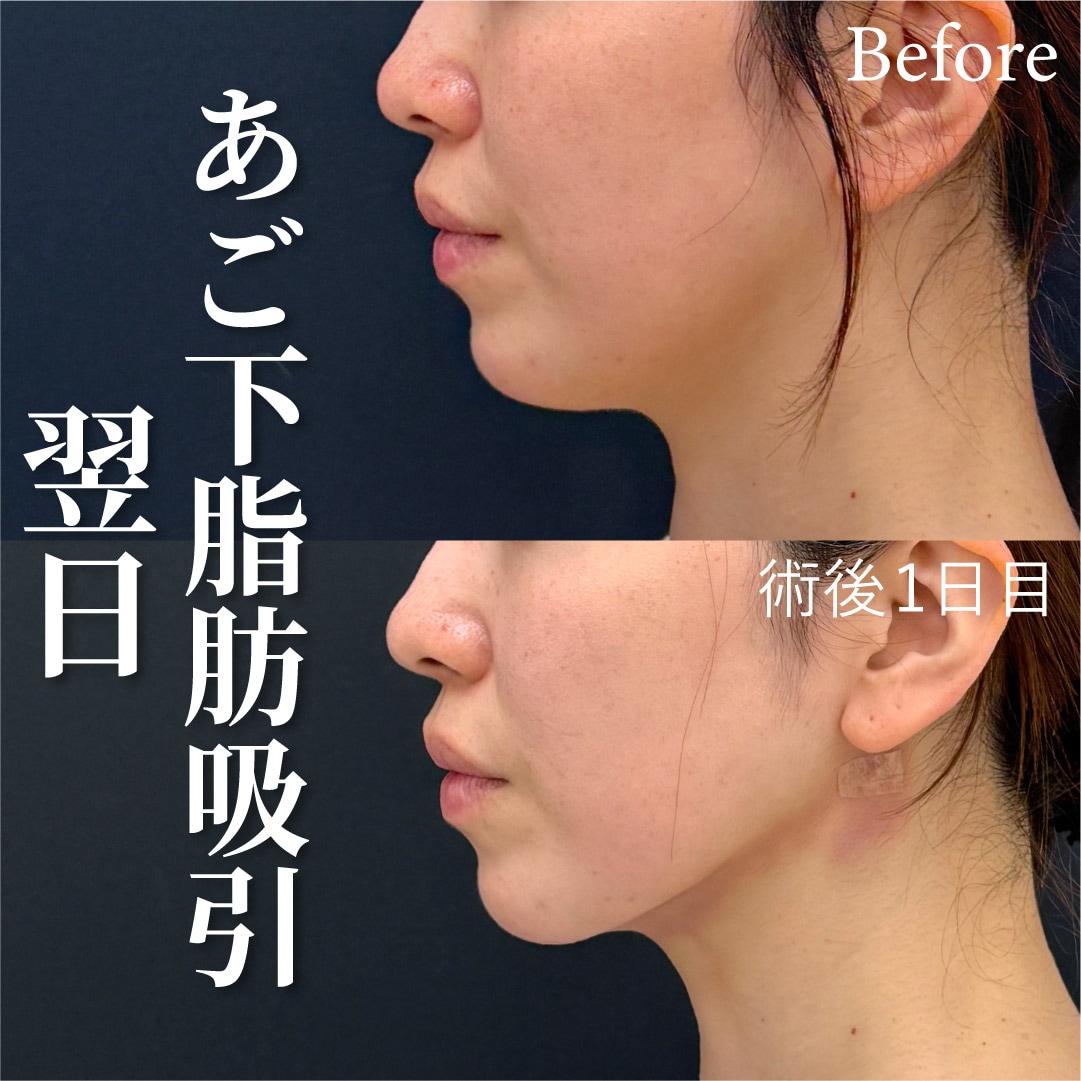 ダウンタイム最小限へのこだわり