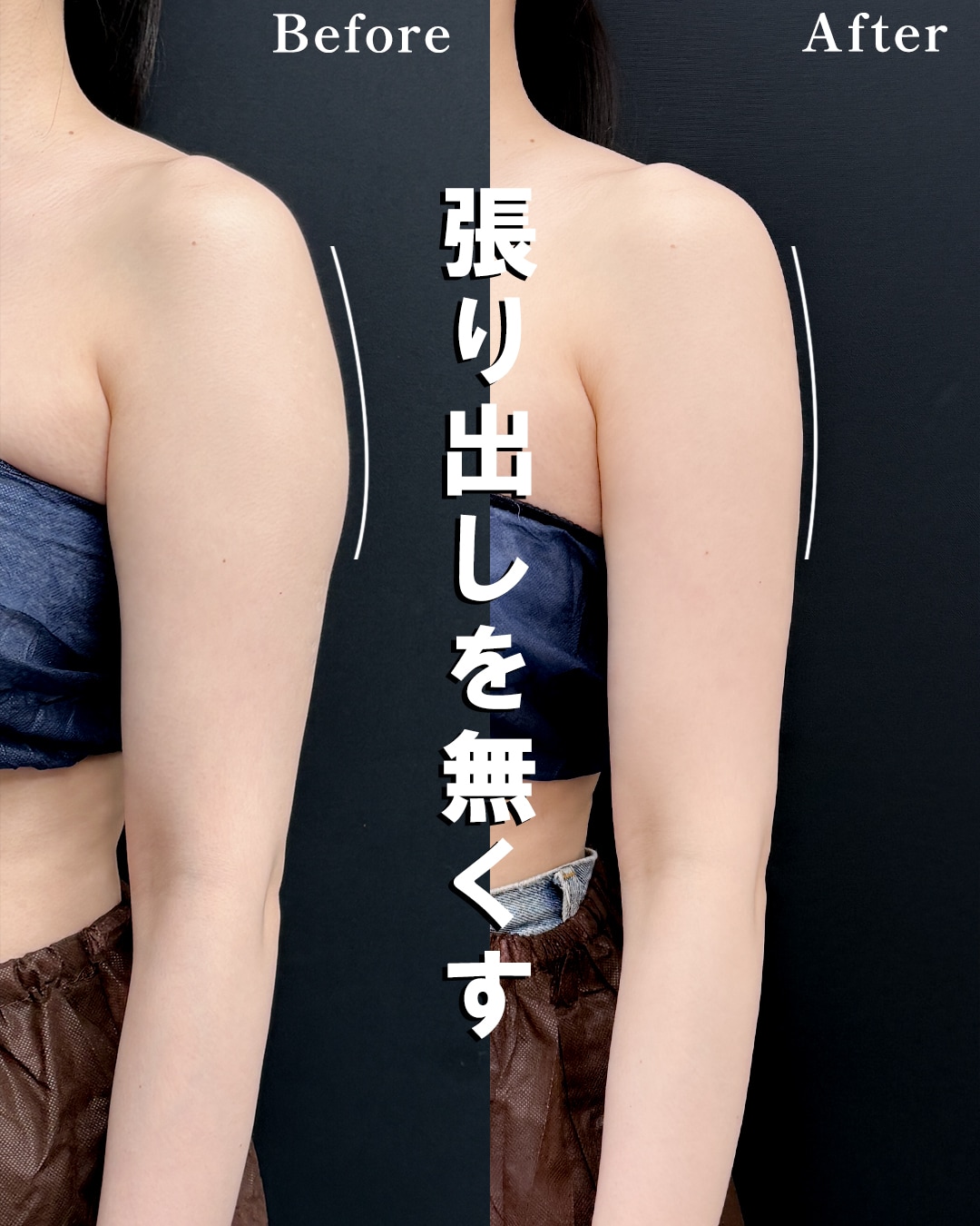 ３０代のモニター様
