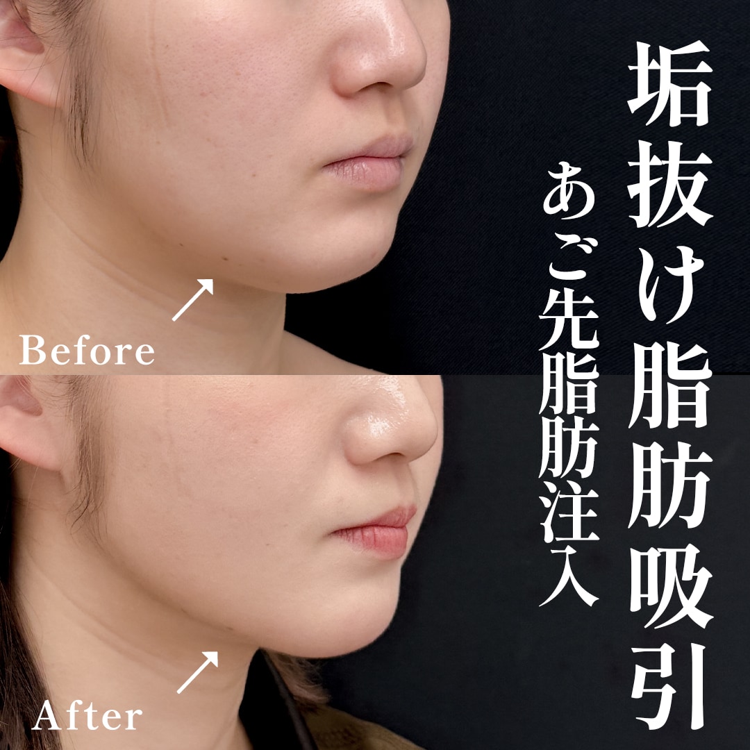 20代女性のモニター様