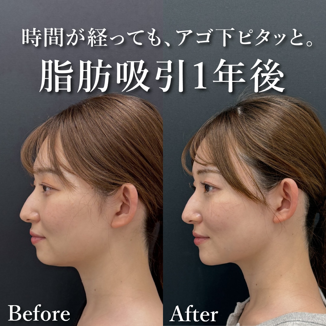 20代女性のモニター様