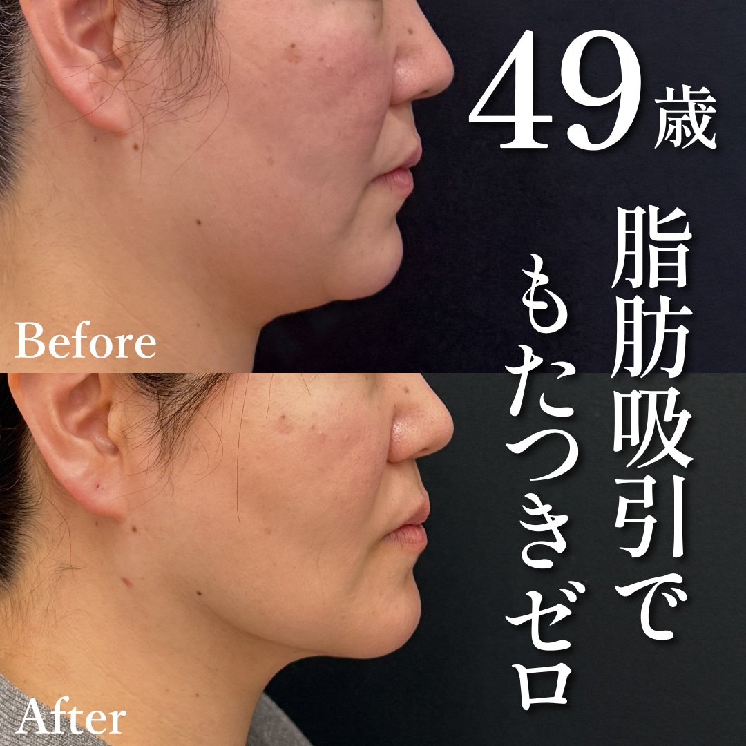 40代女性のモニター様