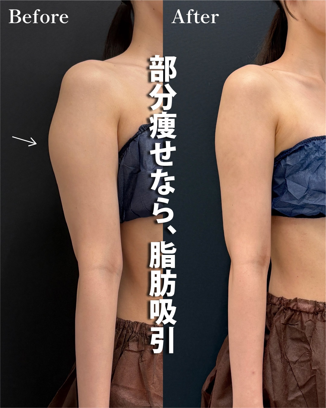 23歳のモニター様
