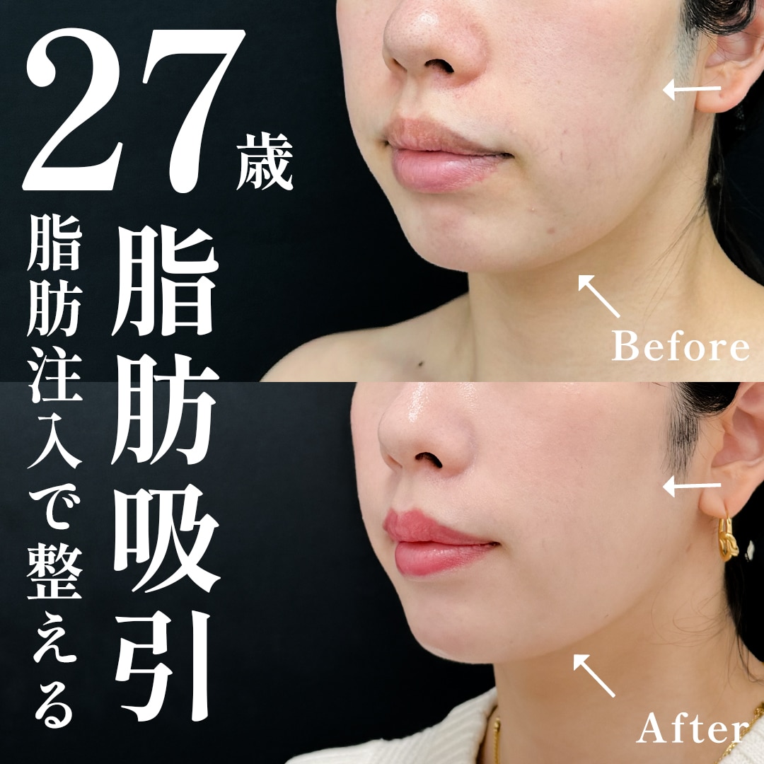20代女性のモニター様