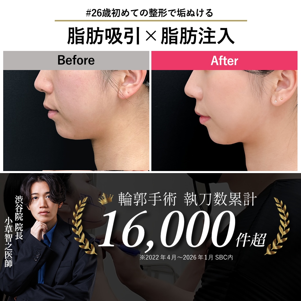 【顔脂肪吸引の名医】人生が変わる大きな決断！「やってよかった」と思える理想の小顔デザイン