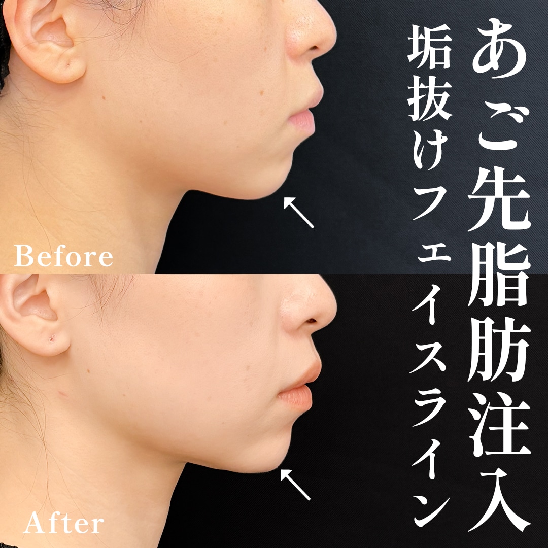30代女性のモニター様