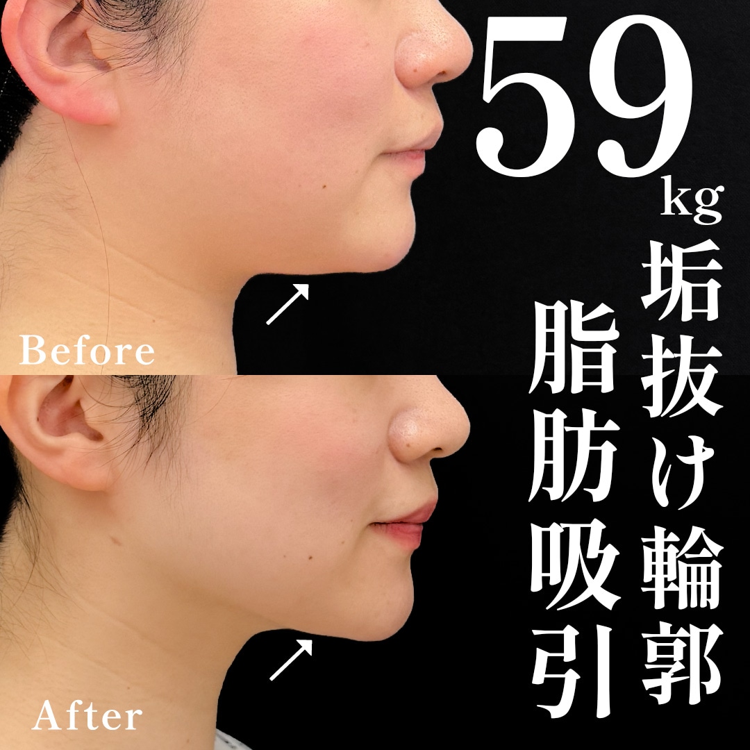 30代女性のモニター様