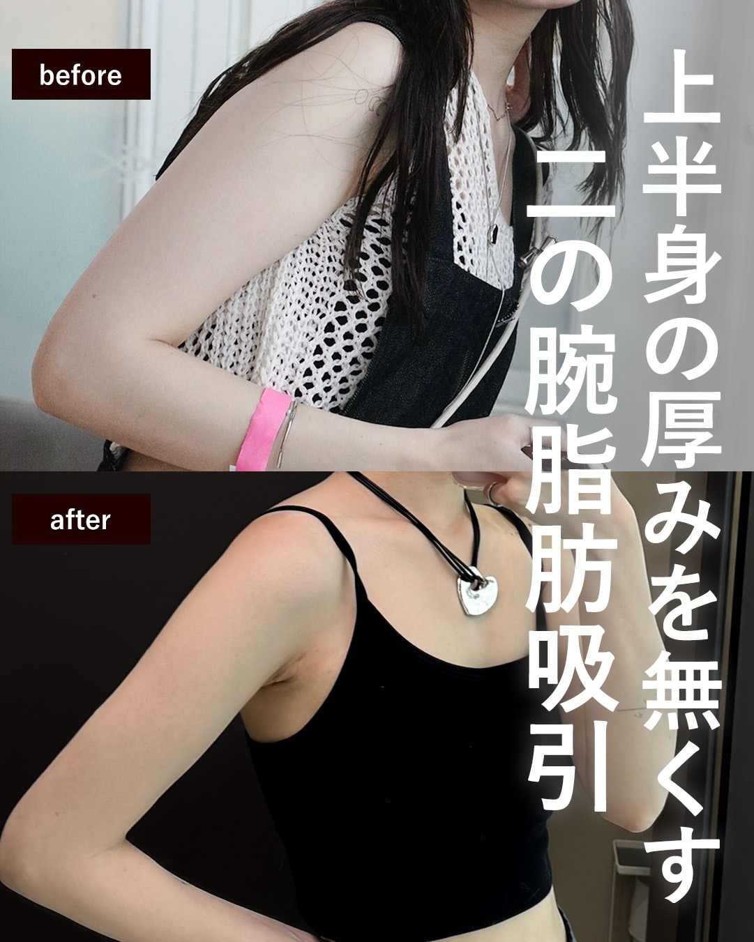 2０代のモニター様