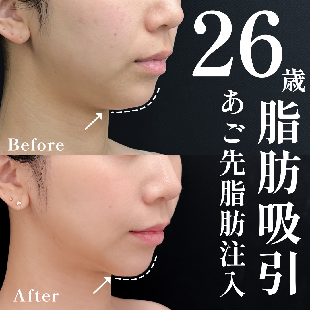 20代女性のモニター様