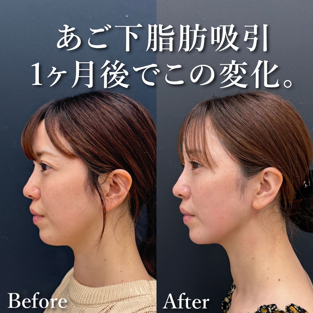 30代女性のモニター様