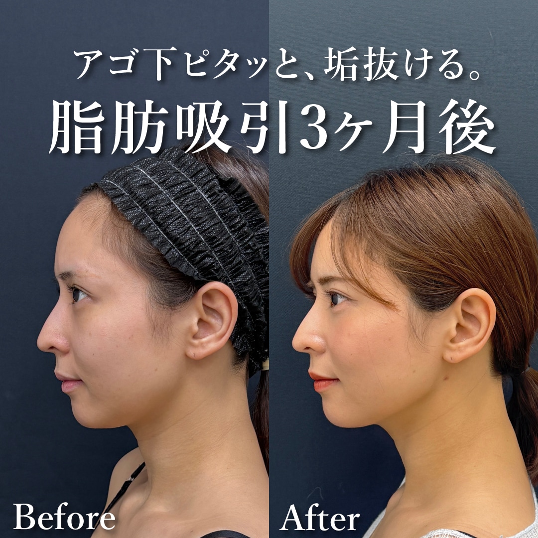 30代女性のモニター様