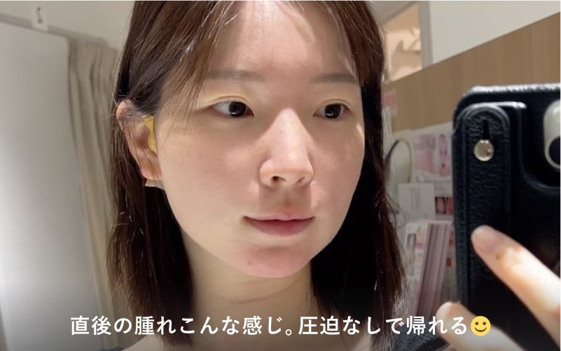 施術当日