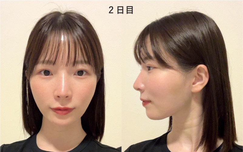 2日目