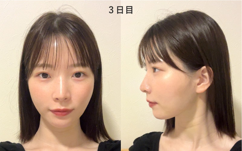 3日目