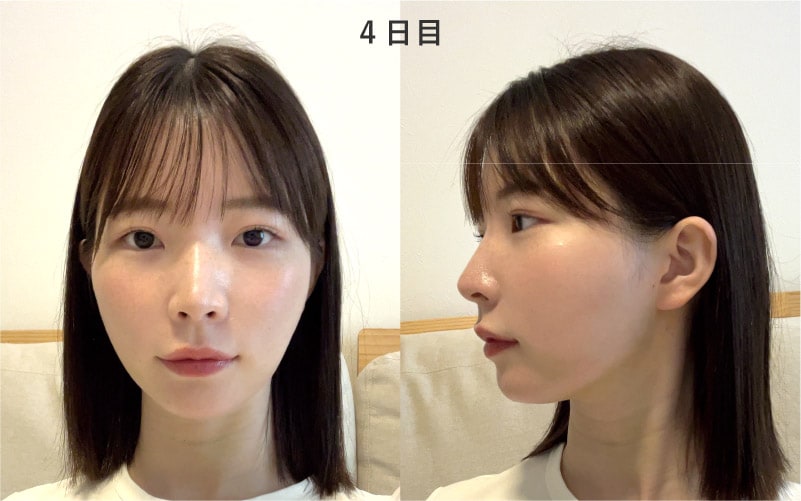 4日目