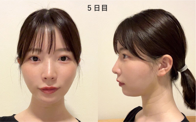 5日目