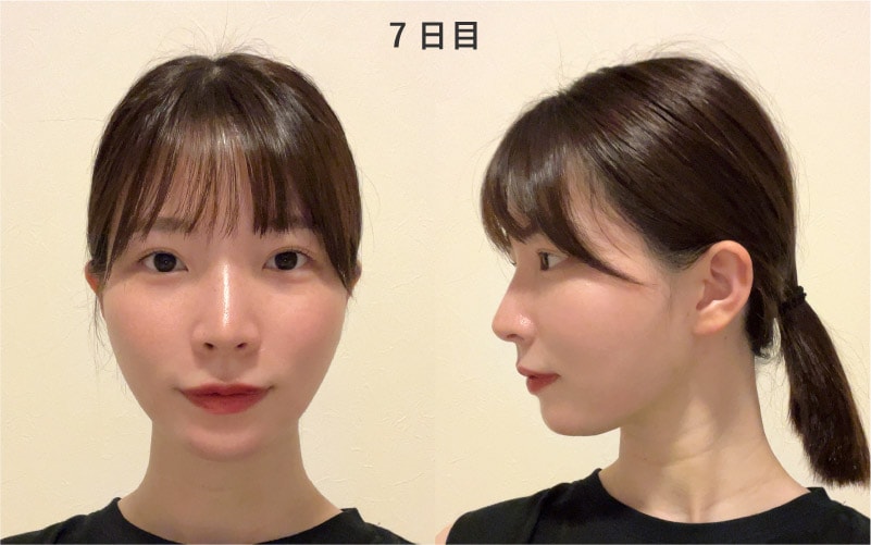 7日目