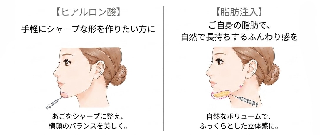 さらなる美しさをプラス