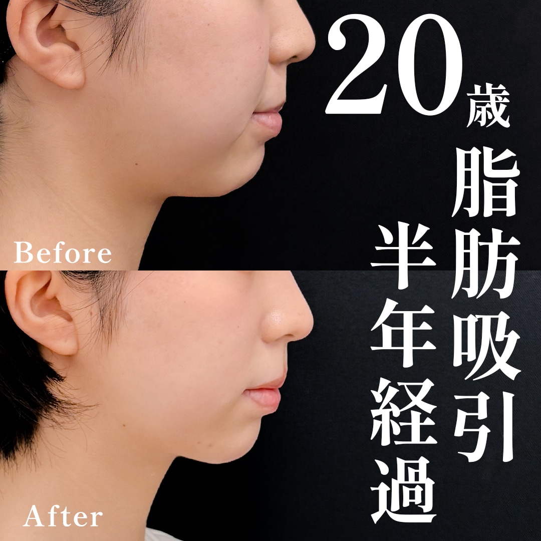 20代女性のモニター様