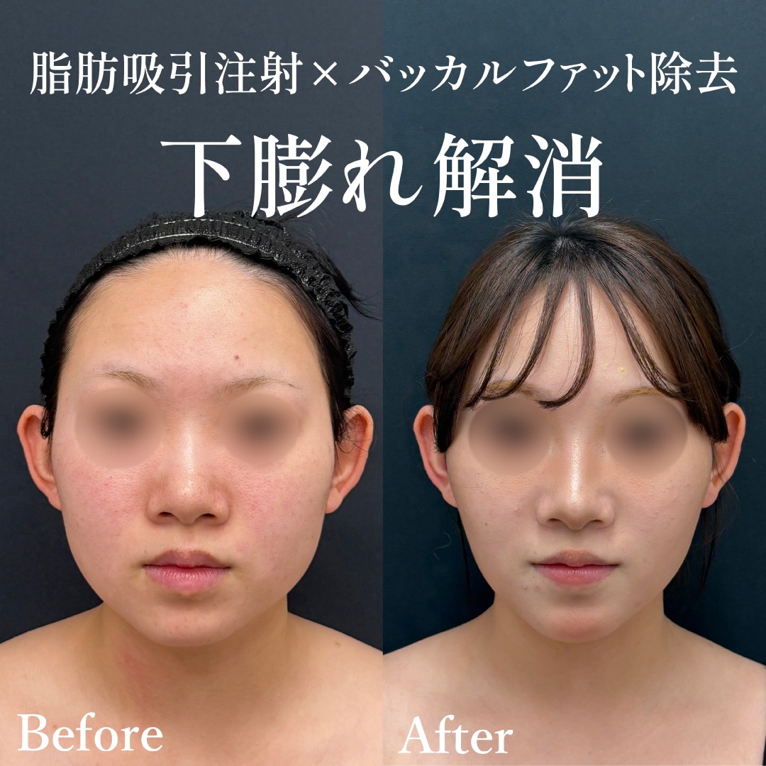 10代女性のモニター様