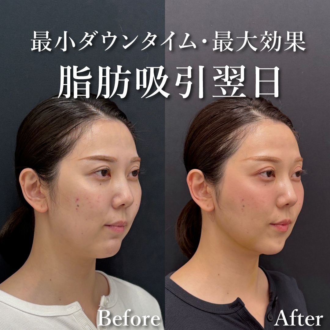 30代女性のモニター様