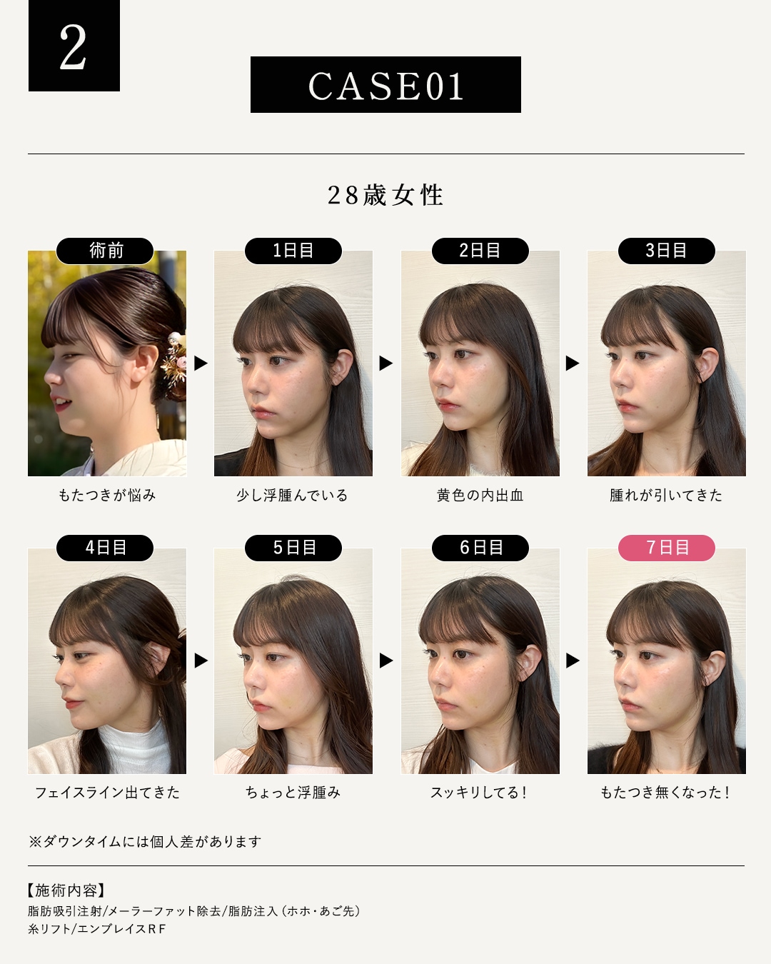 28歳女性のモニター様