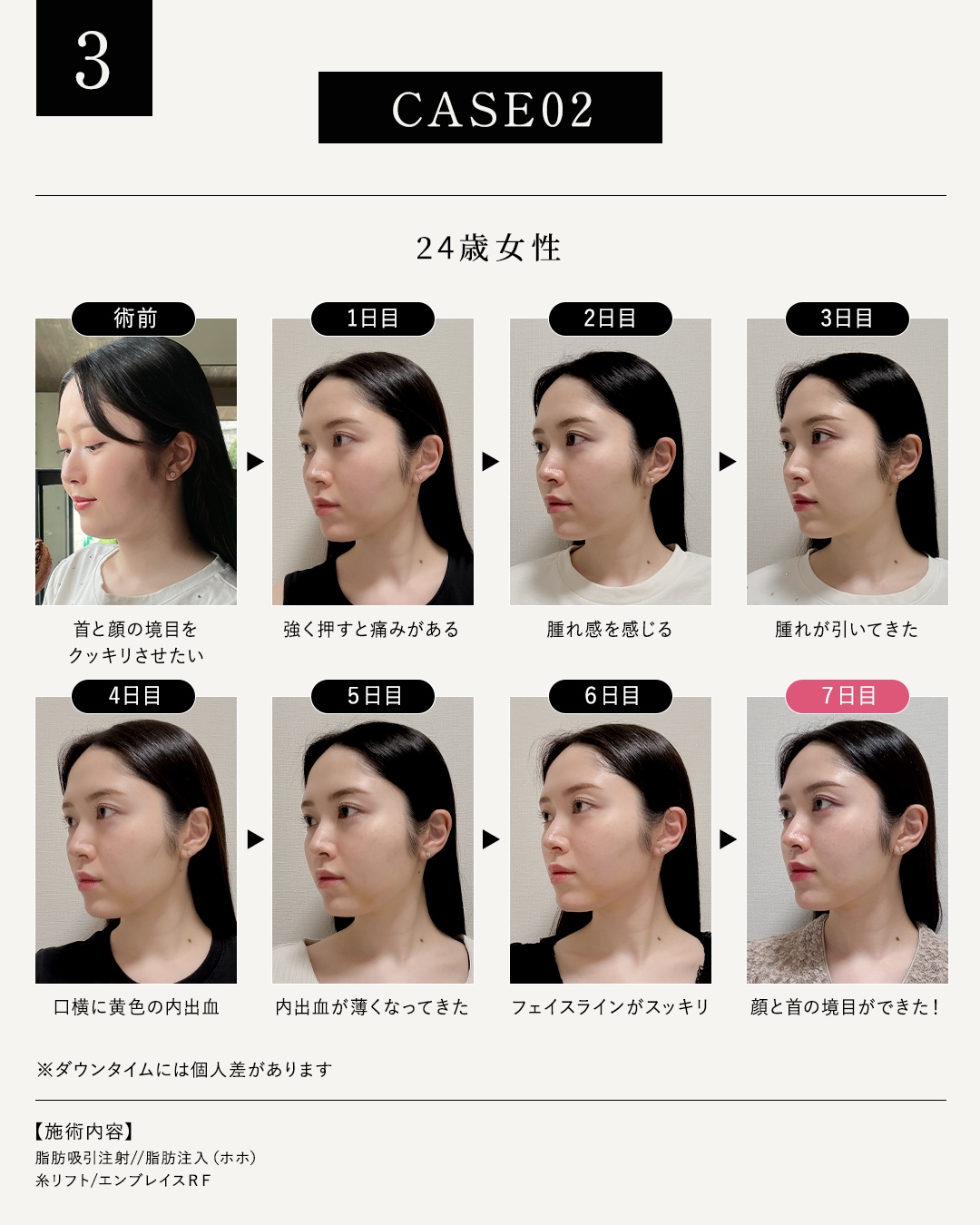 24歳女性のモニター様