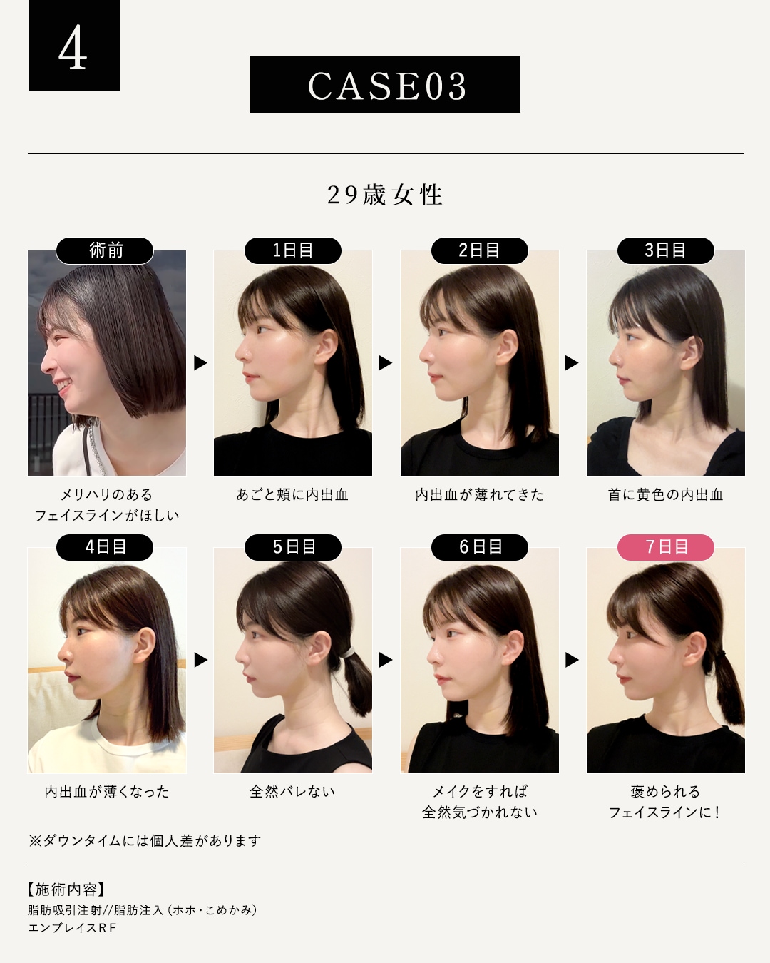 29歳女性のモニター様