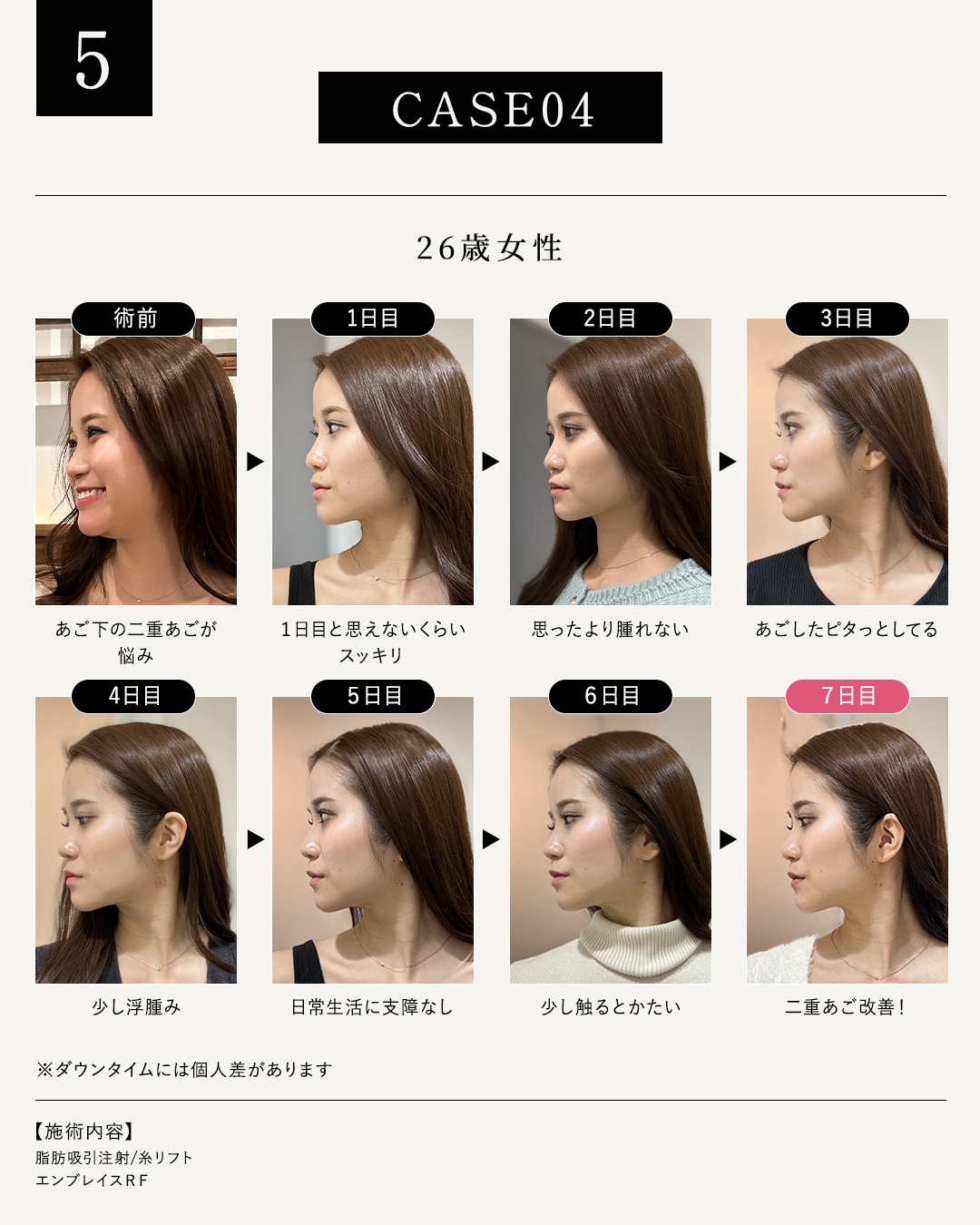 26歳女性のモニター様