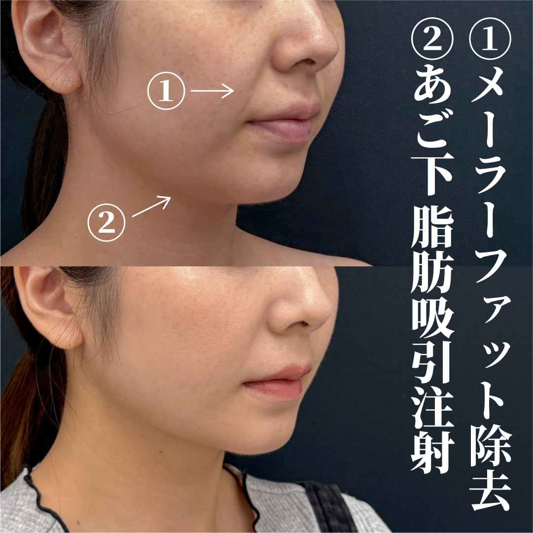 30代女性のモニター様