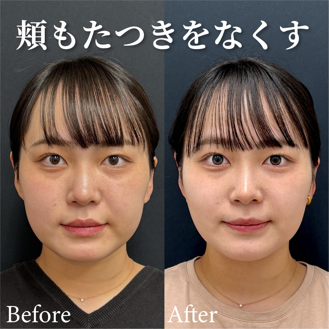 下重心→上重心の輪郭に