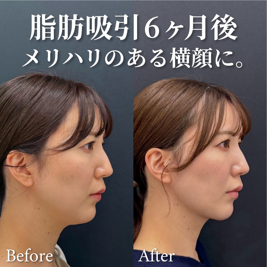 顔と首の境目をくっきり