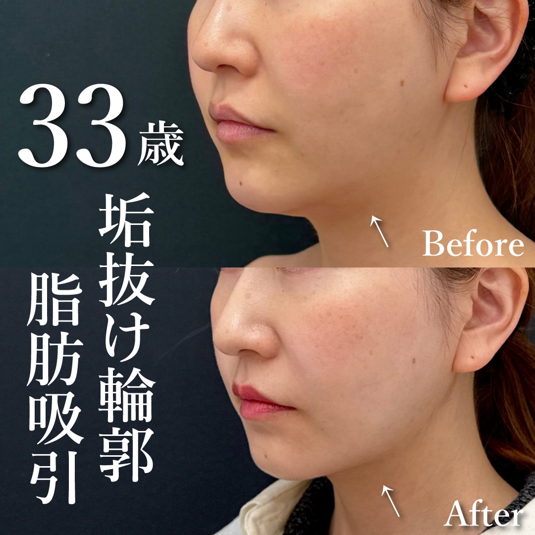 30代女性のモニター様