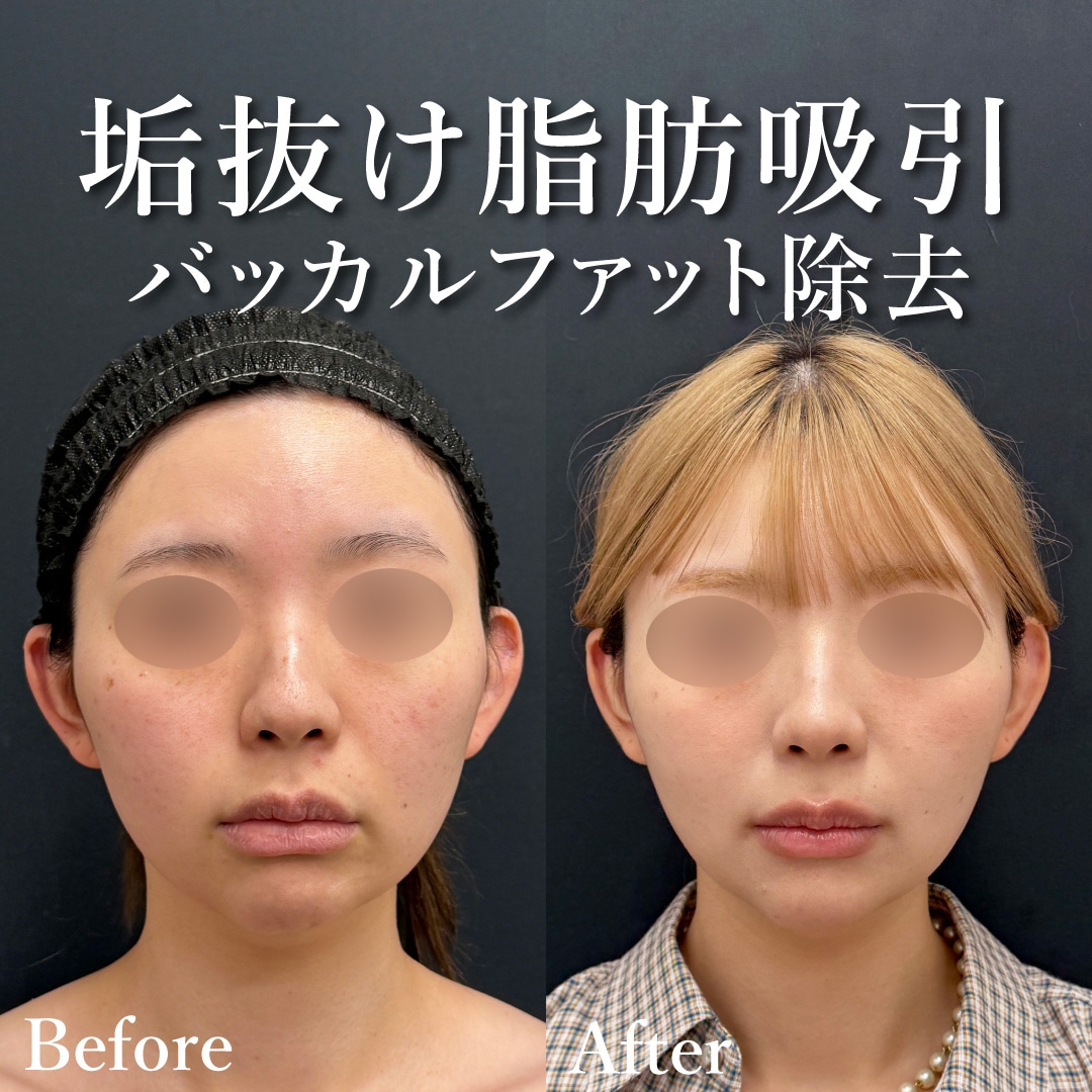 30代女性のモニター様