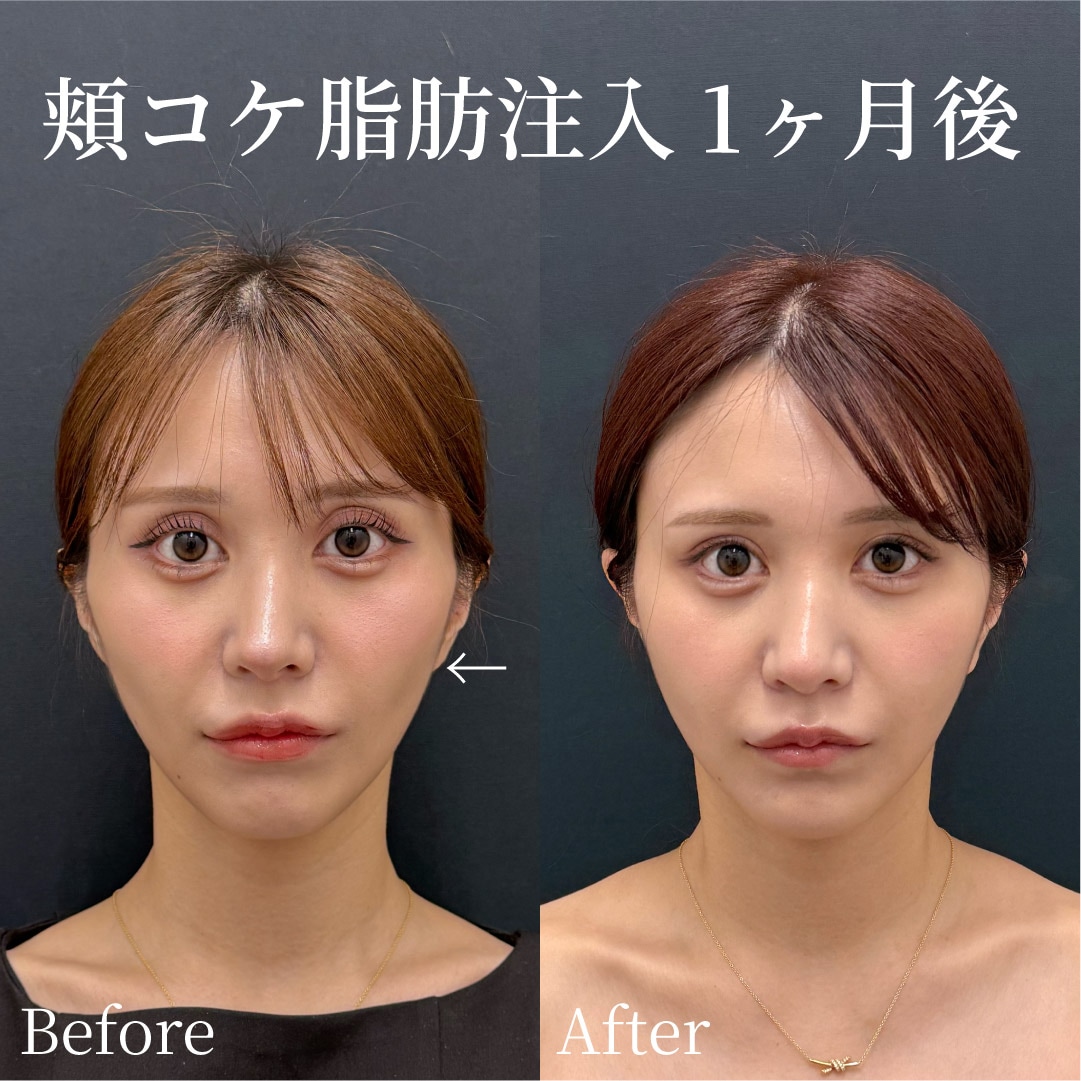 24歳女性のモニター様