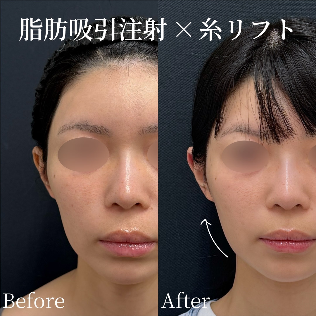 31歳女性のモニター様<br />
