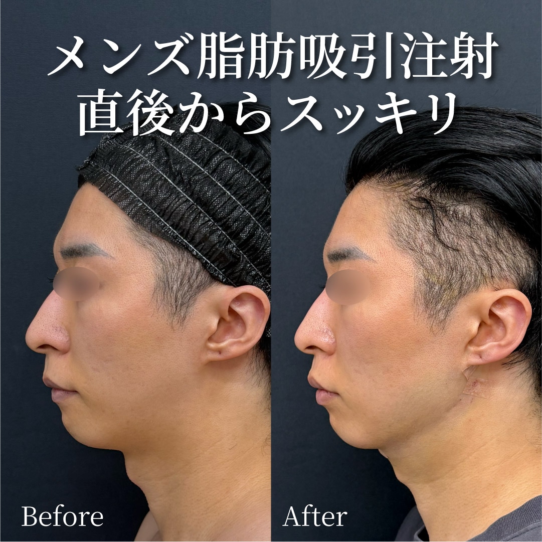 28歳男性のモニター様<br />
