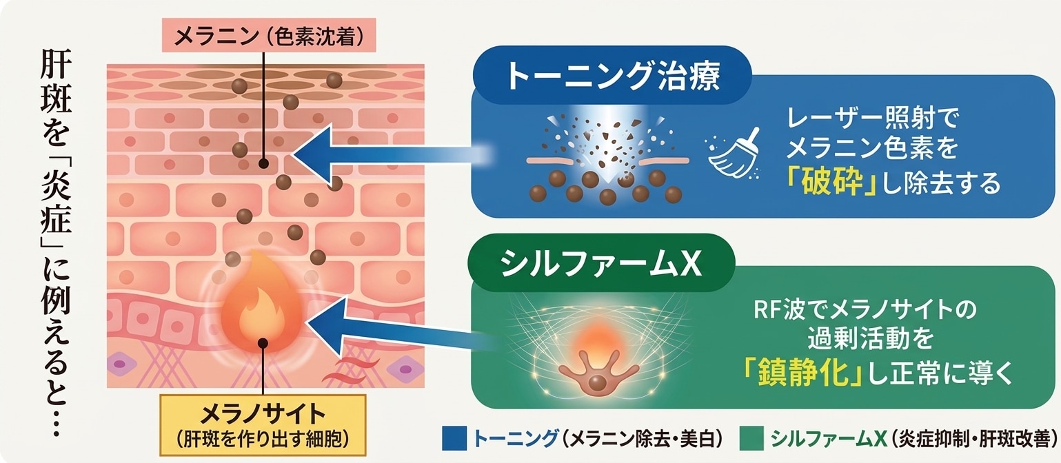 肝斑や毛穴・色くすみを同時に改善
