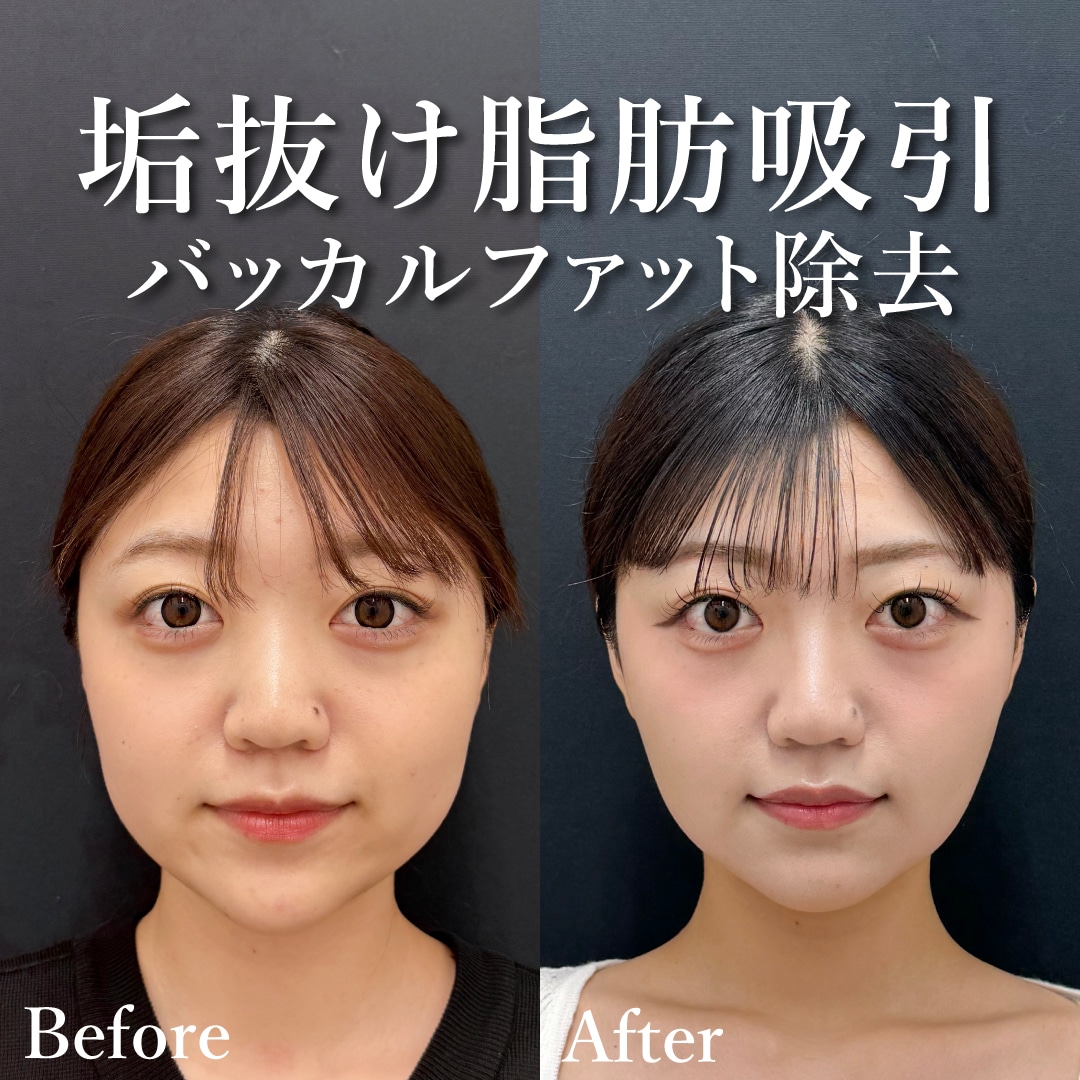 20代女性のモニター様