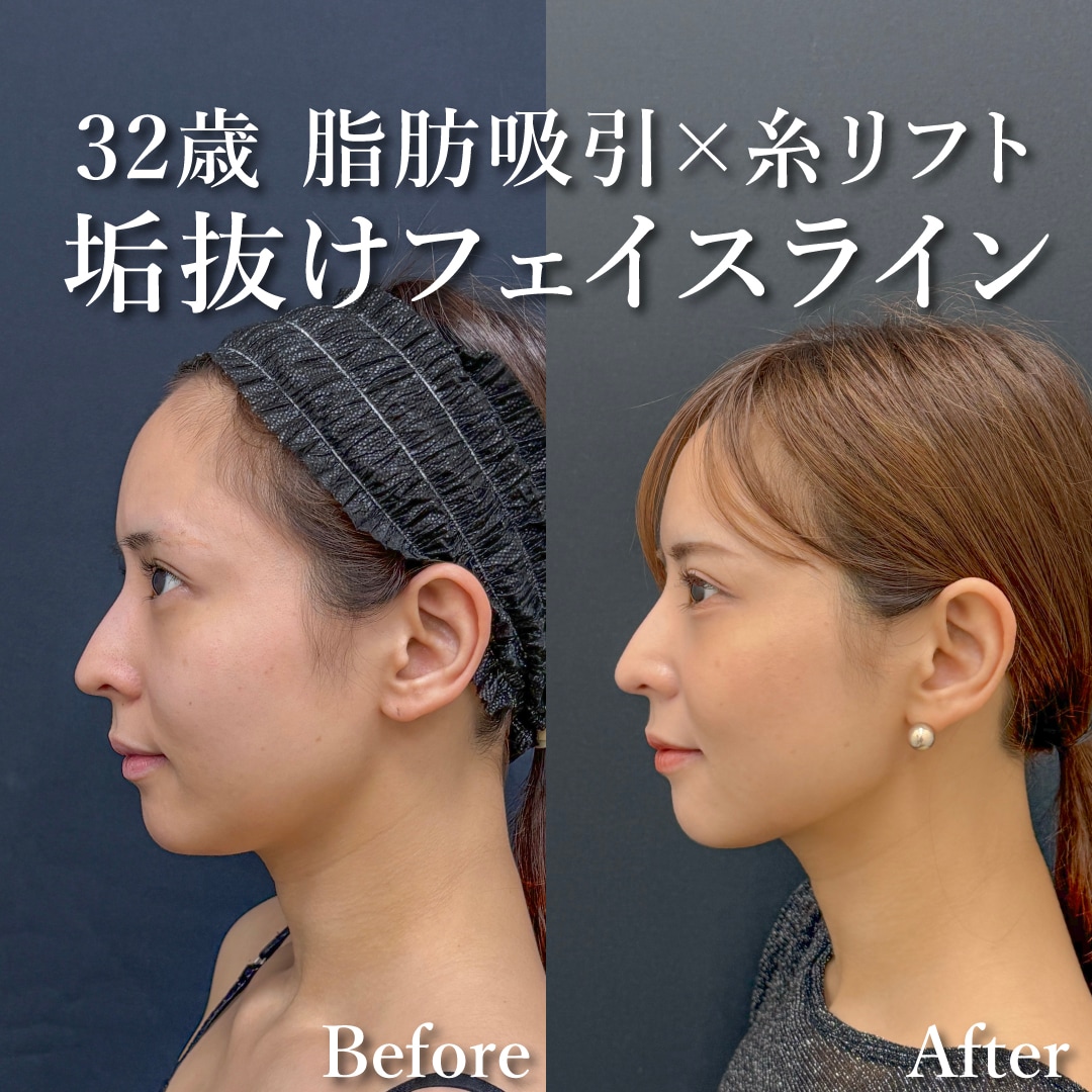30代女性のモニター様