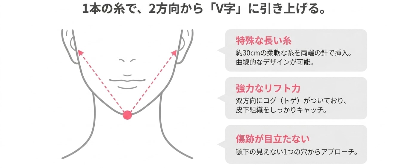 切らずに速攻！二重あごを撃退する最新リフトアップ