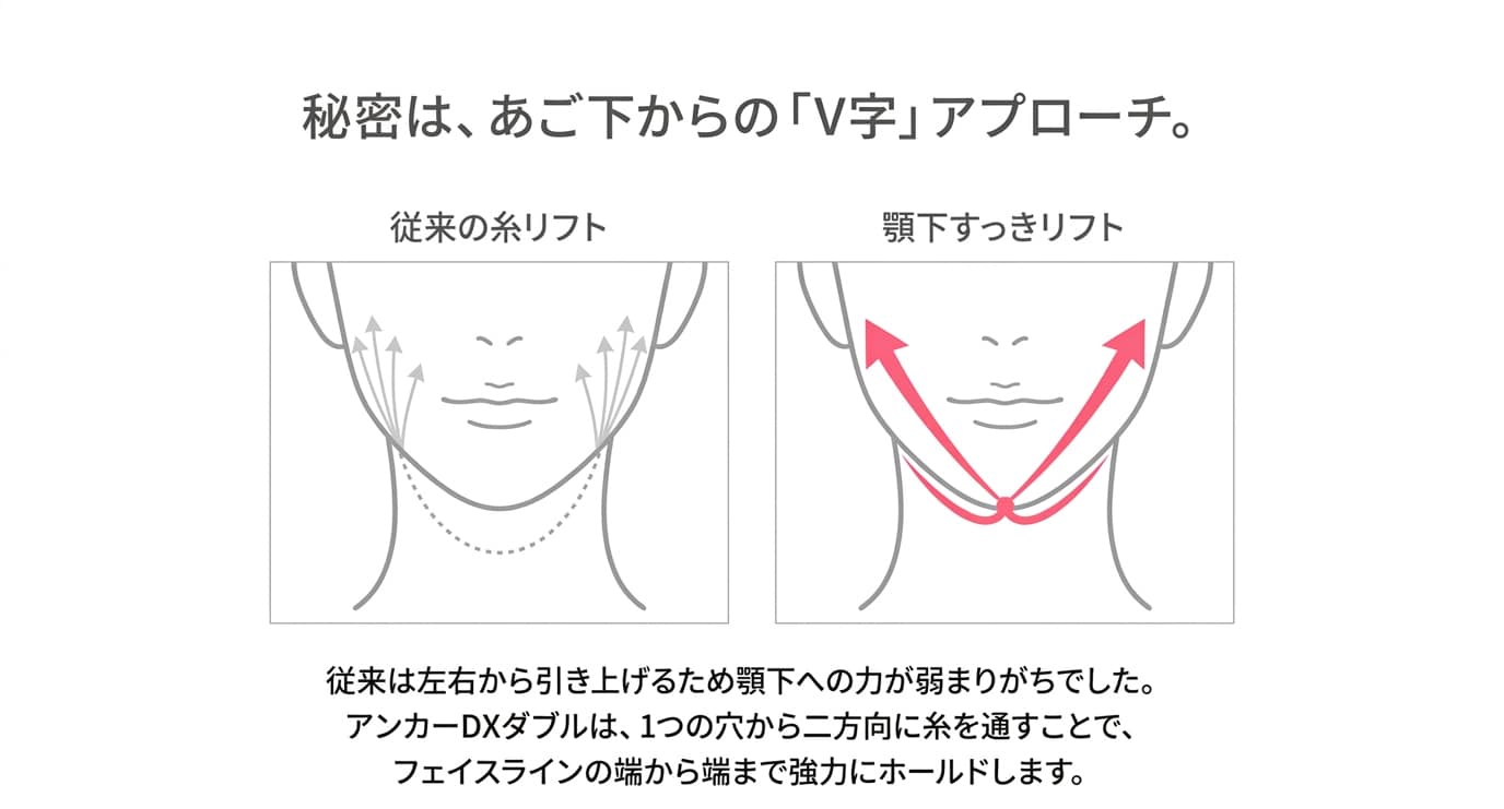1本で2本分の効果！V字で強力に引き上げる秘密
