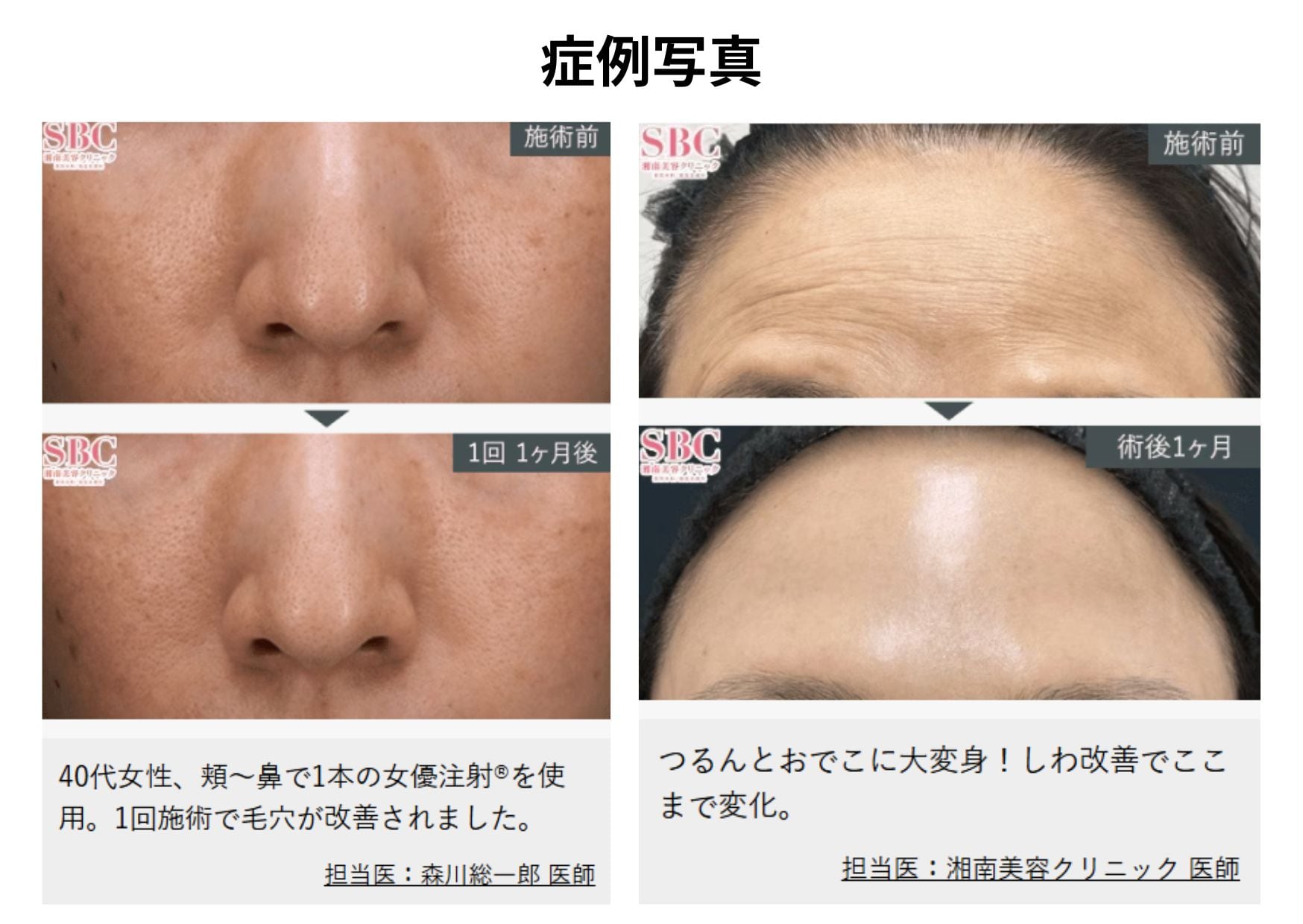 2つの成分が肌の奥でWアプローチ
