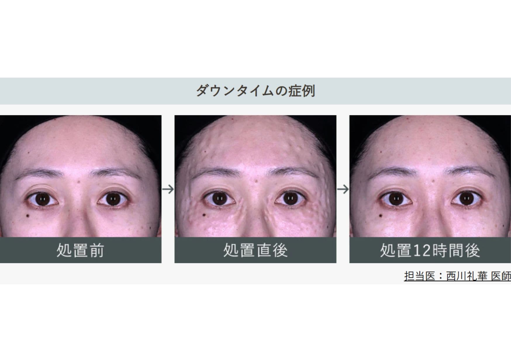 気軽に受けられて、憧れの美肌へ