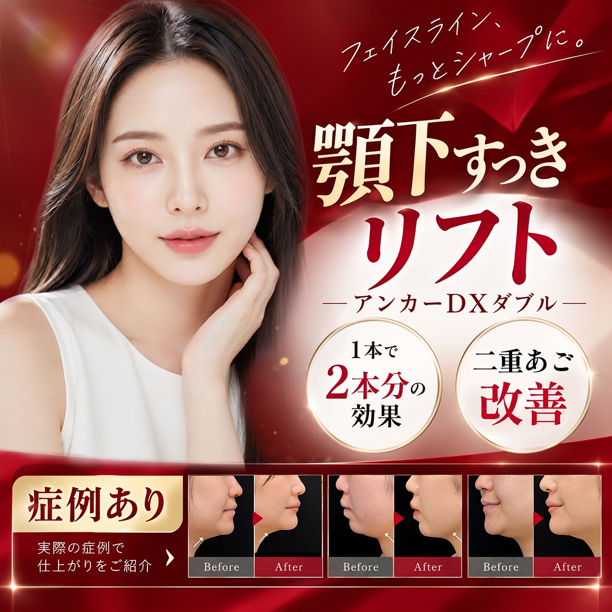 【症例あり】切らずに二重あご解消!「顎下すっきリフト(アンカーDXダブル)」の効果を徹底解説