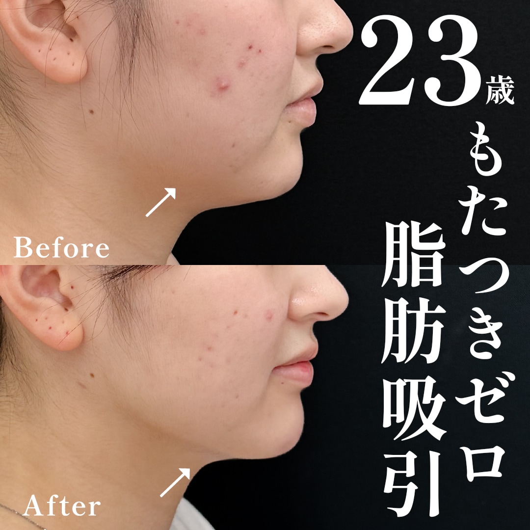 20代女性のモニター様