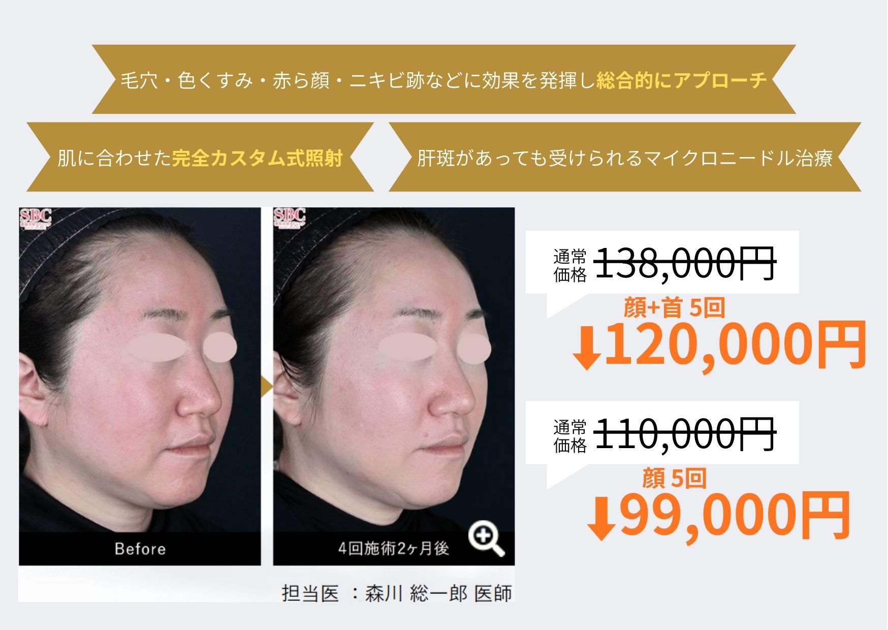 シルファームX