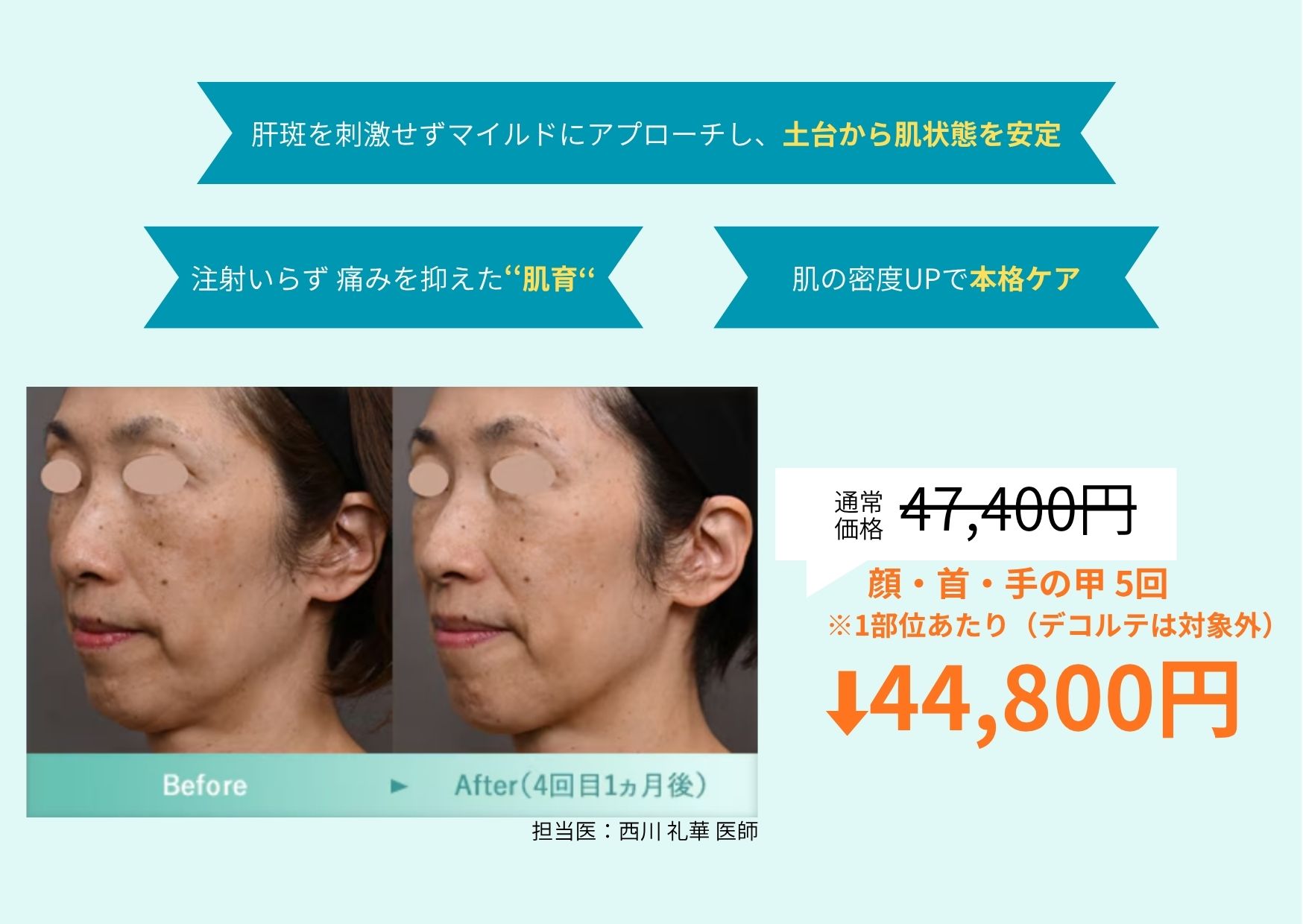 フォトジェネシス
