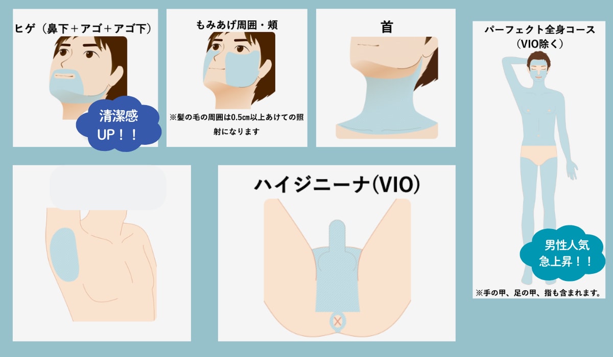 湘南 美容 外科 脱毛 メンズ